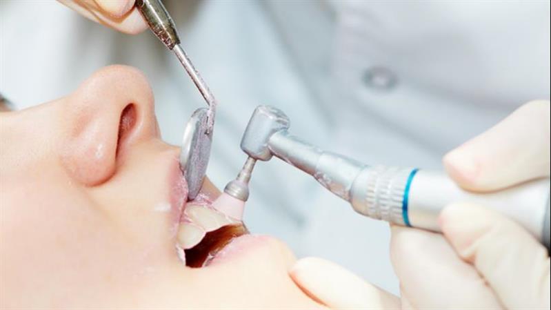 Teeth cleaning and polishing - Skin and Teeth Medical Center - Ajman - UAE