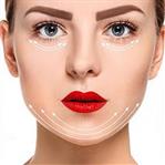 Chin contour - Texas - V-Line - Skin and Teeth Medical Center - Ajman - UAE