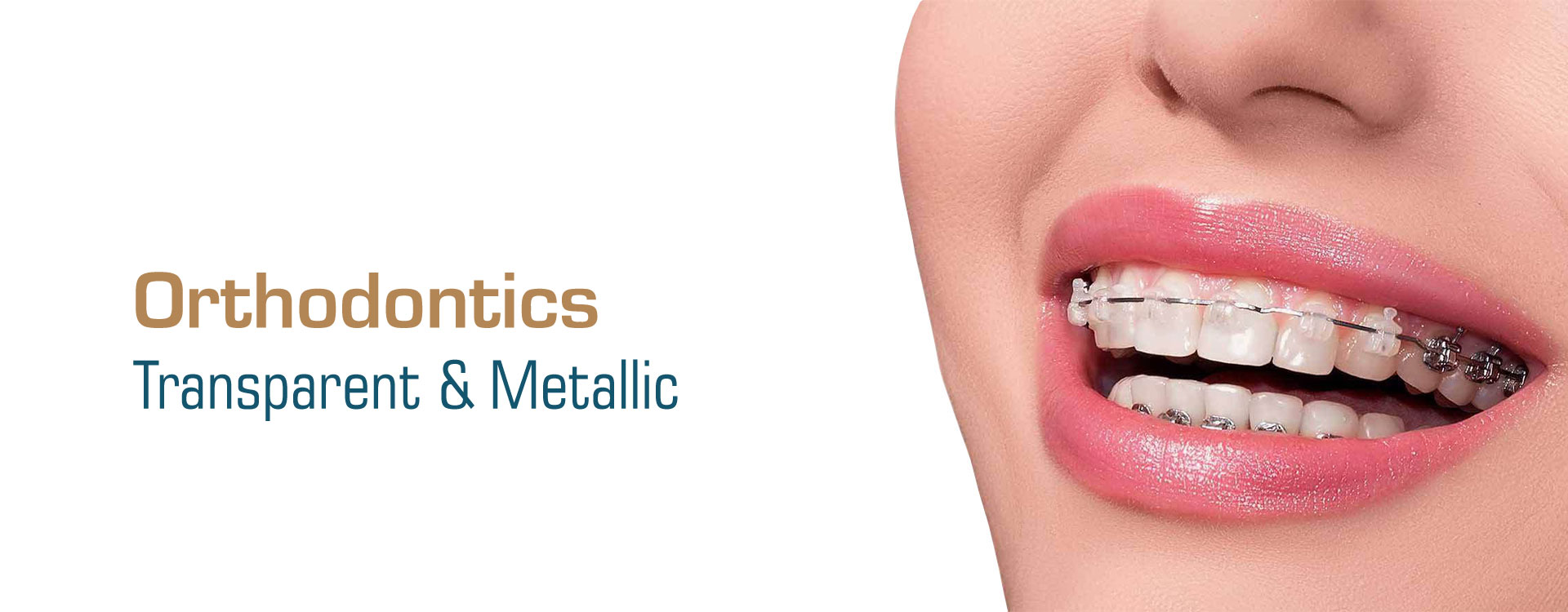 Orthodontics - Skin and Teeth Medical Center - Ajman - UAE